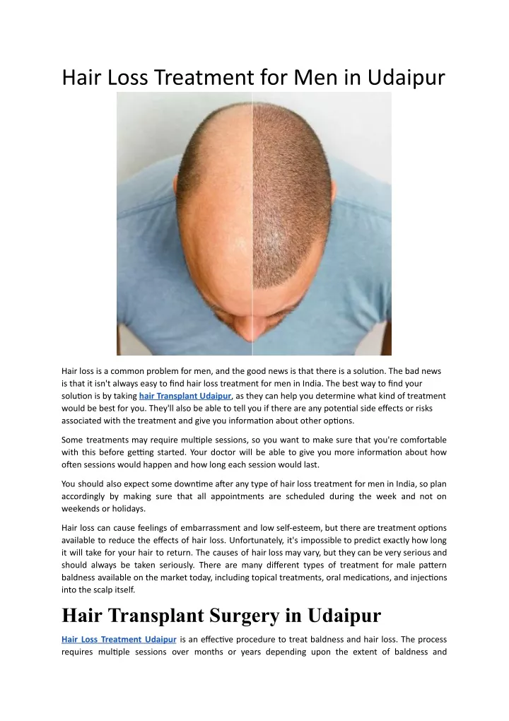 hair loss treatment for men in udaipur