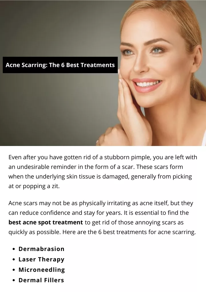 acne scarring the 6 best treatments