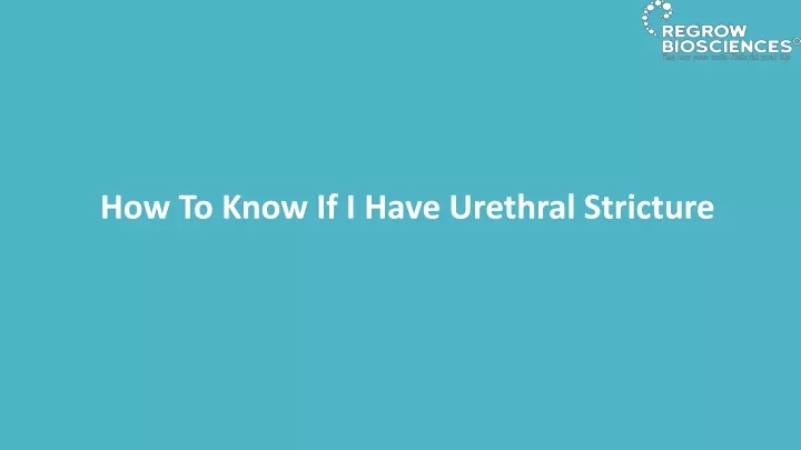how to know if i have urethral stricture