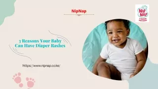 3 Reasons Your Baby Can Have Diaper Rashes