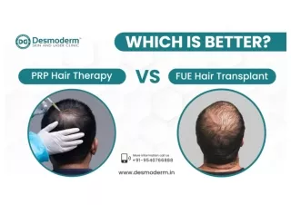 Best PRP Hair Therapy vs. FUE Hair Transplant | Desmoderm