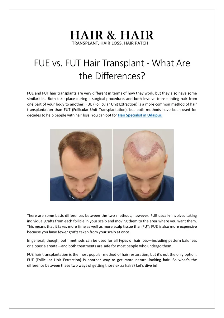 fue vs fut hair transplant what