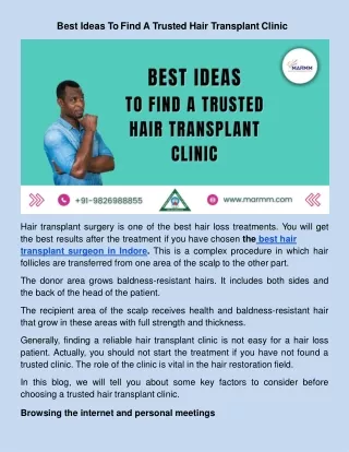 Best Ideas To Find A Trusted Hair Transplant Clinic