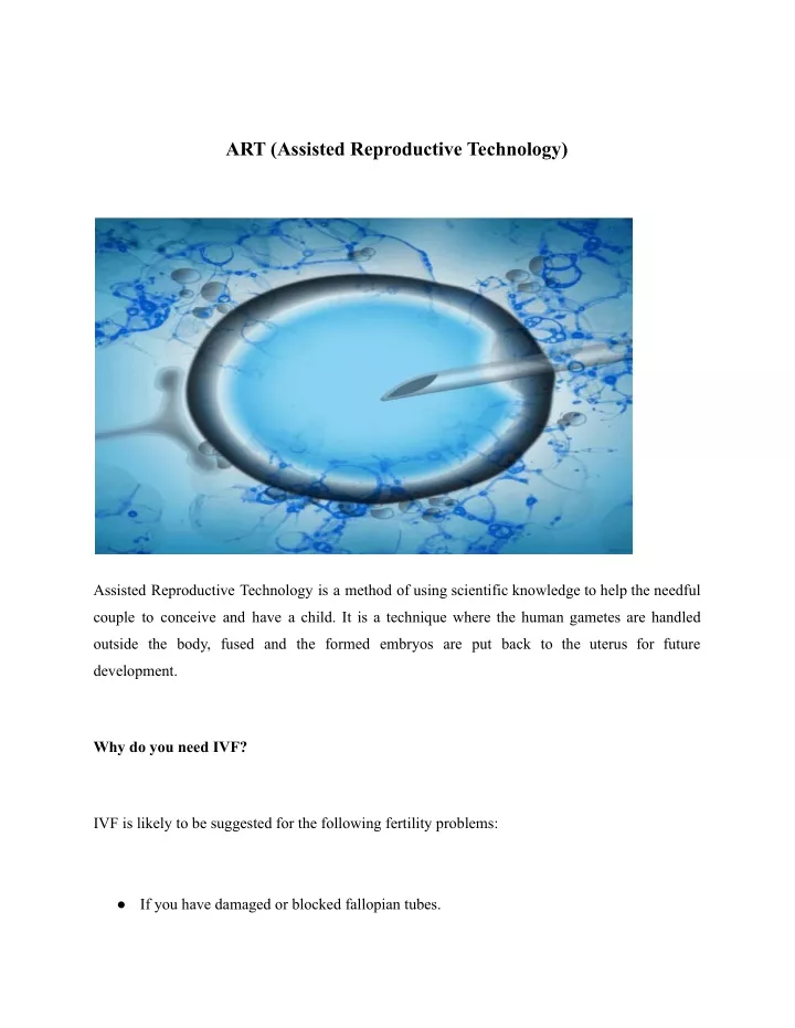 art assisted reproductive technology