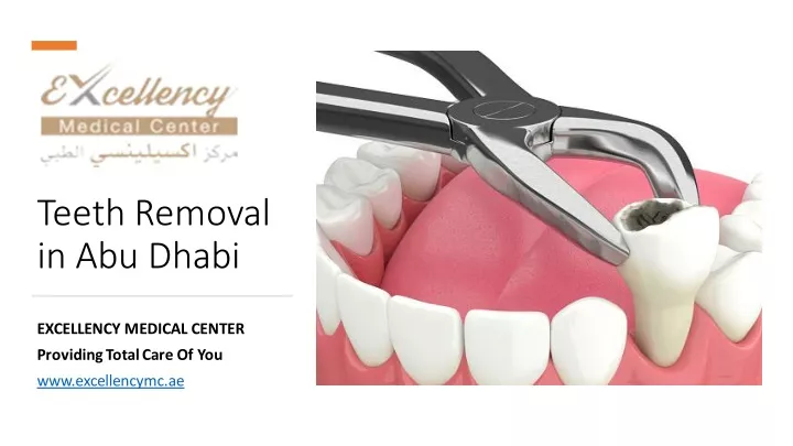 teeth removal in abu dhabi