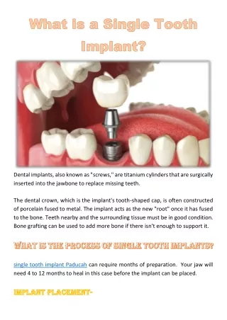 dental implants also known as screws are titanium