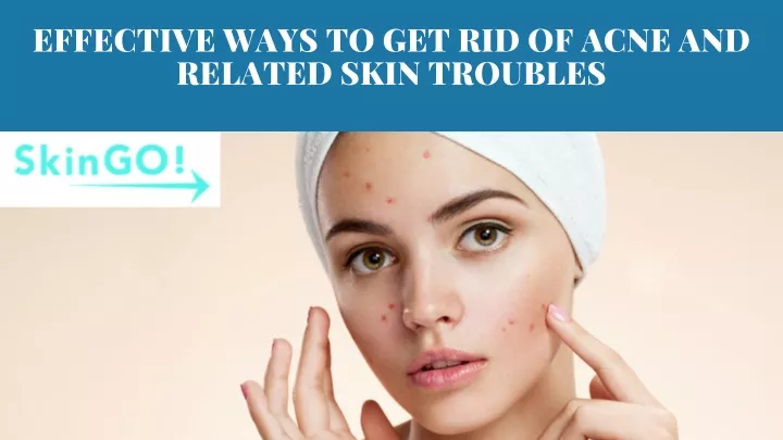 effective ways to get rid of acne and related