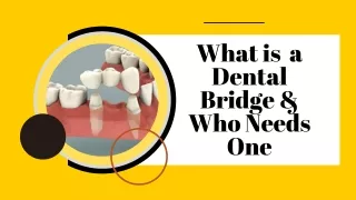 What is  a Dental Bridge & Who Needs One