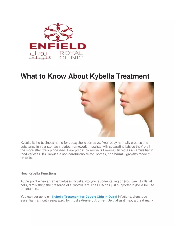 what to know about kybella treatment