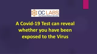 A Covid-19 Test can reveal whether you have been exposed to the Virus