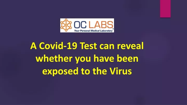 a covid 19 test can reveal whether you have been exposed to the virus