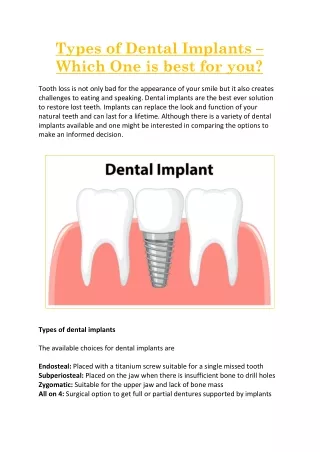 Types of Dental Implants – Which One is best for you?