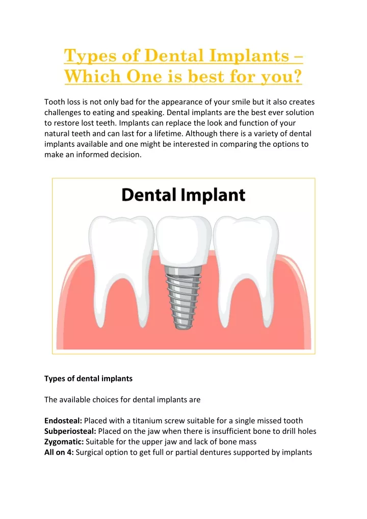 types of dental implants which one is best for you