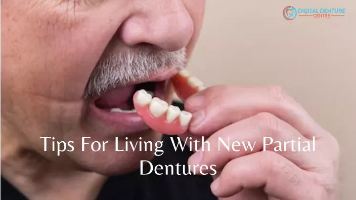 tips for living with new partial dentures