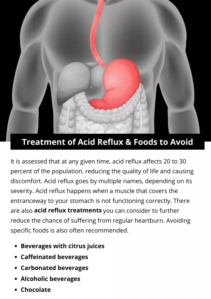 treatment of acid reflux foods to avoid