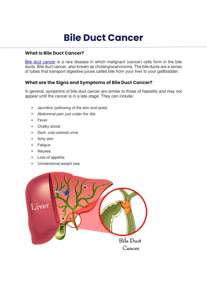 bile duct cancer