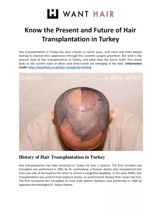 Know the Present and Future of Hair Transplantation in Turkey