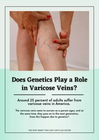 Does Genetics Play a Role in Varicose Veins