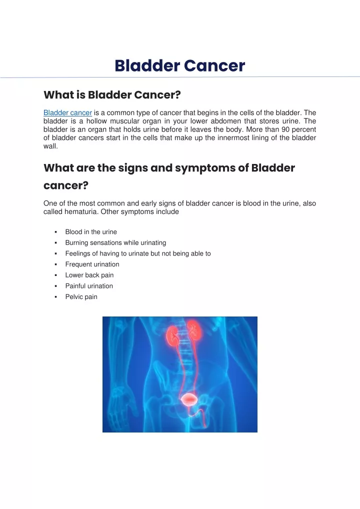 bladder cancer