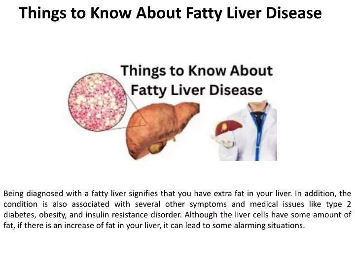 things to know about fatty liver disease