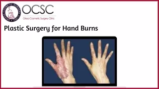 Plastic Surgery for Hand Burns