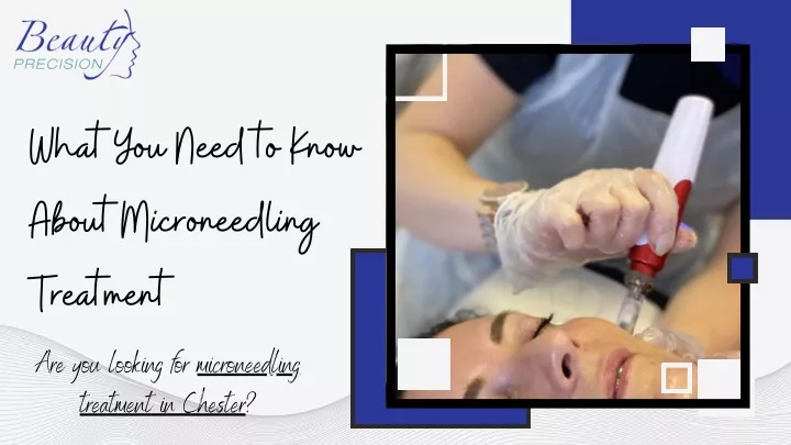 what you need to know about microneedling