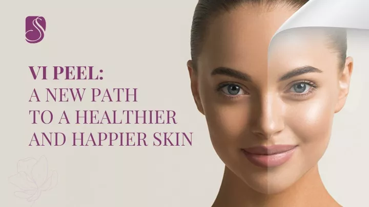 vi peel a new path to a healthier and happier skin