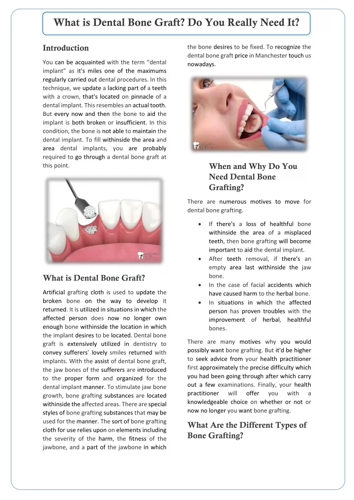 what is dental bone graft do you really need it