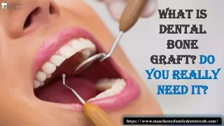 What is Dental Bone Graft? Do You Really Need It?