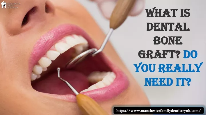 what is dental bone graft do you really need it