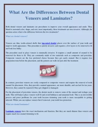 what are the differences between dental veneers
