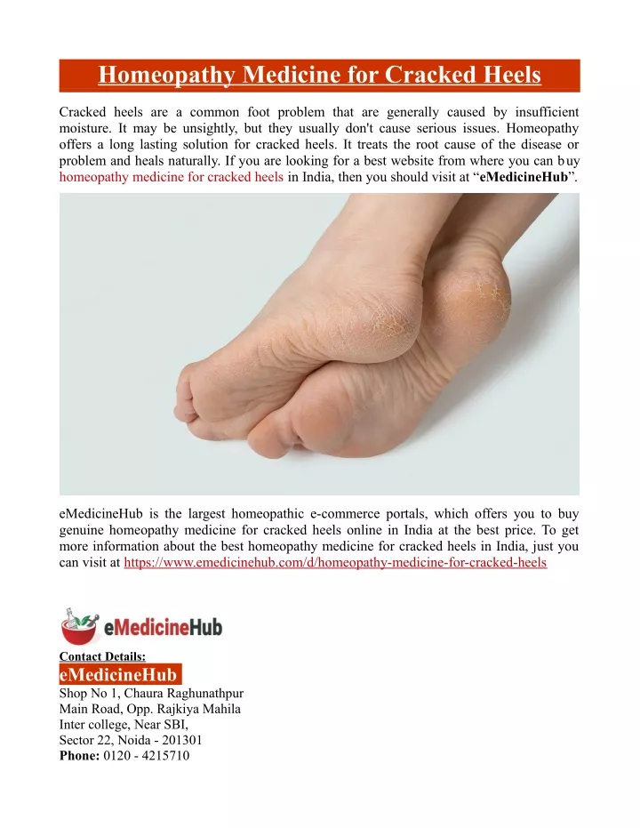 homeopathy medicine for cracked heels