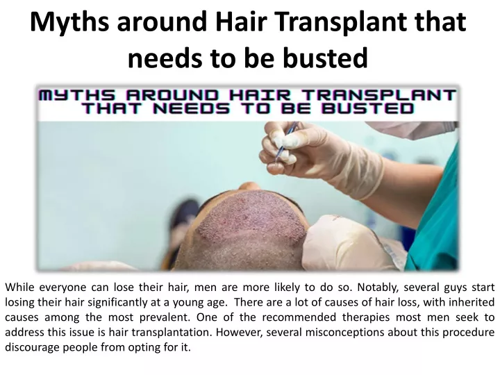 myths around hair transplant that needs