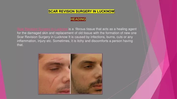 scar revision surgery in lucknow