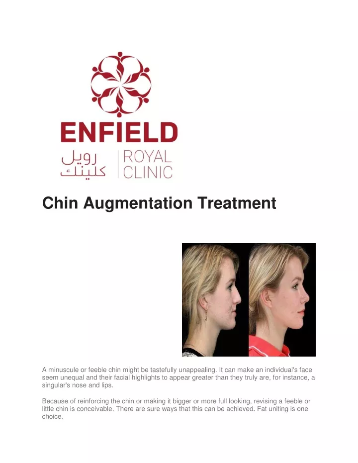 chin augmentation treatment