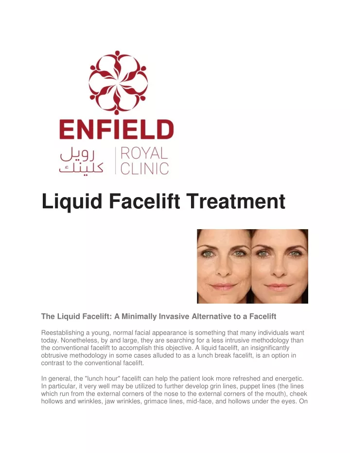 liquid facelift treatment