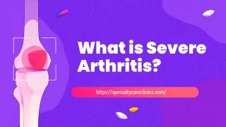 Do you suffer from Arthritis?