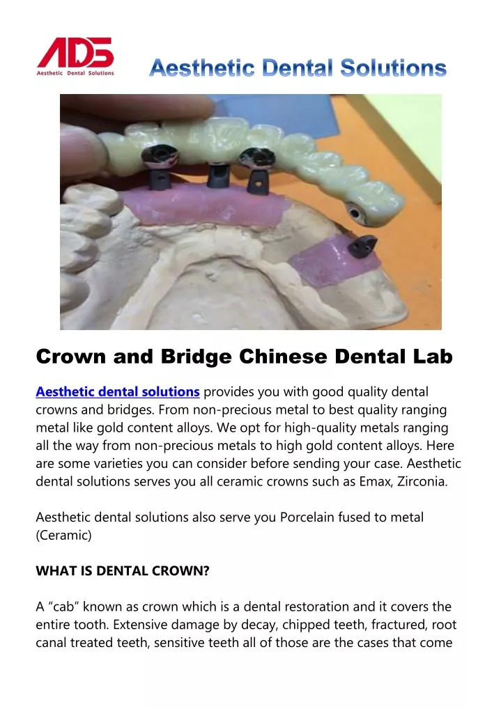 crown and bridge chinese dental lab aesthetic