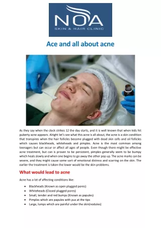 ace and all about acne