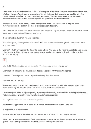 The History of 샌즈카지노