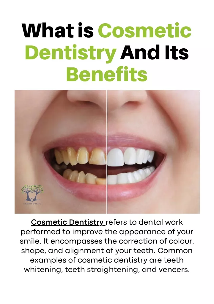 PPT - What Is Cosmetic Dentistry And Its Benefits PowerPoint ...