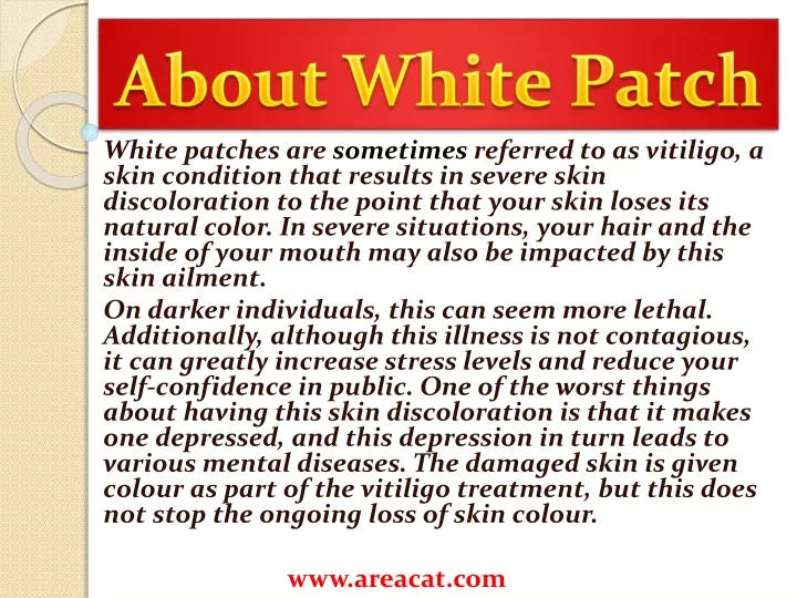 about white patch