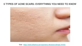 5 TYPES OF ACNE SCARS_ EVERYTHING YOU NEED TO KNOW