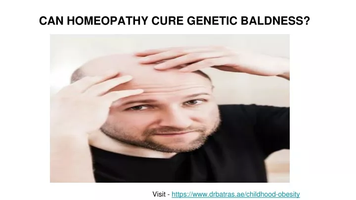can homeopathy cure genetic baldness