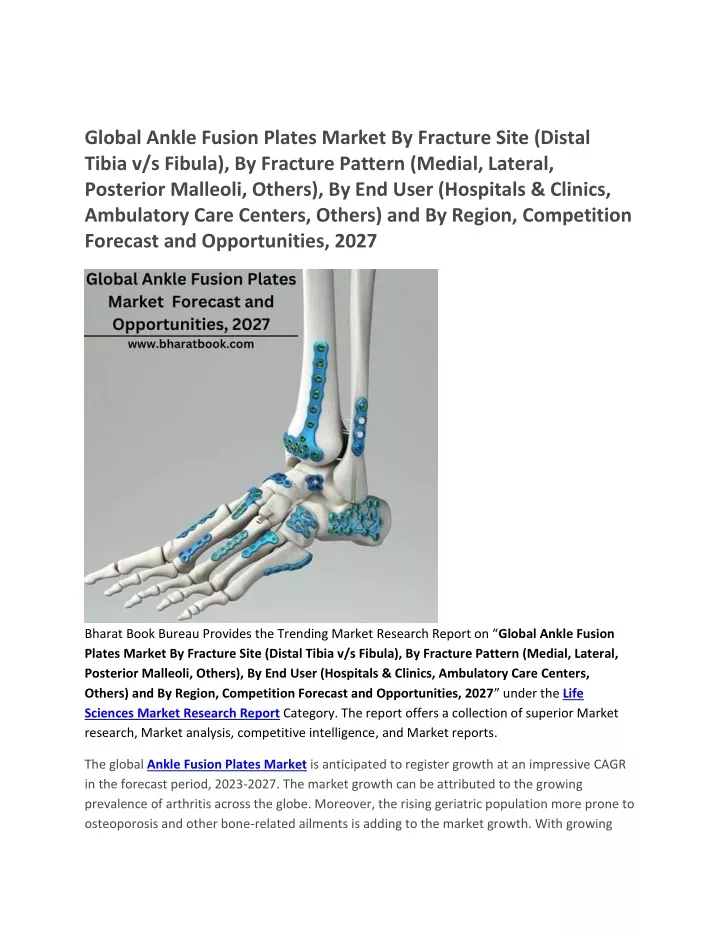 global ankle fusion plates market by fracture