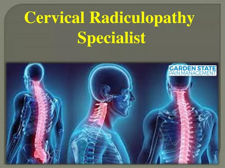 cervical radiculopathy specialist