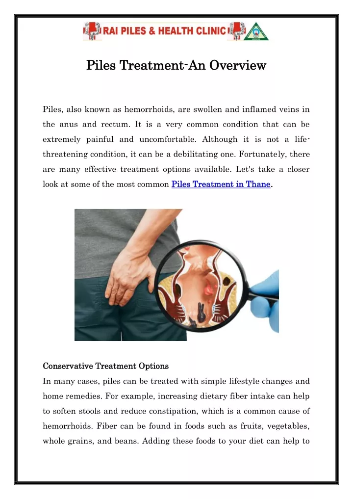 piles treatment piles treatment an overview