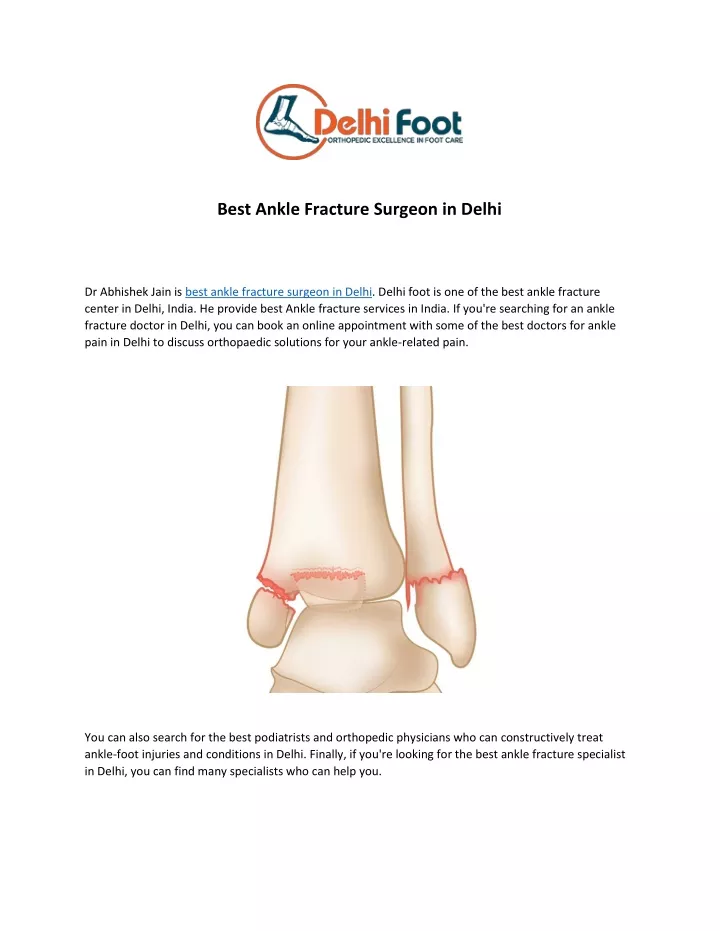 best ankle fracture surgeon in delhi