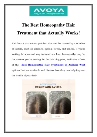 Best Homeopathy Hair Treatment in Andheri West Call-8451839854