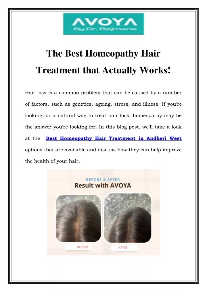 the best homeopathy hair